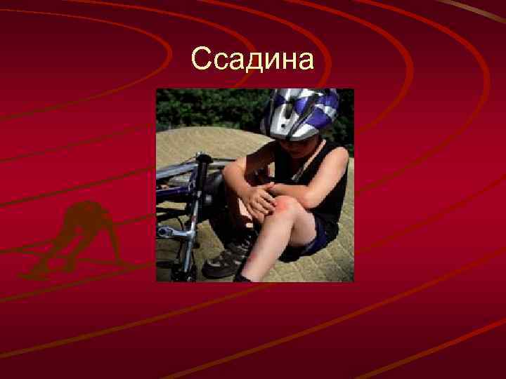 Ссадина 