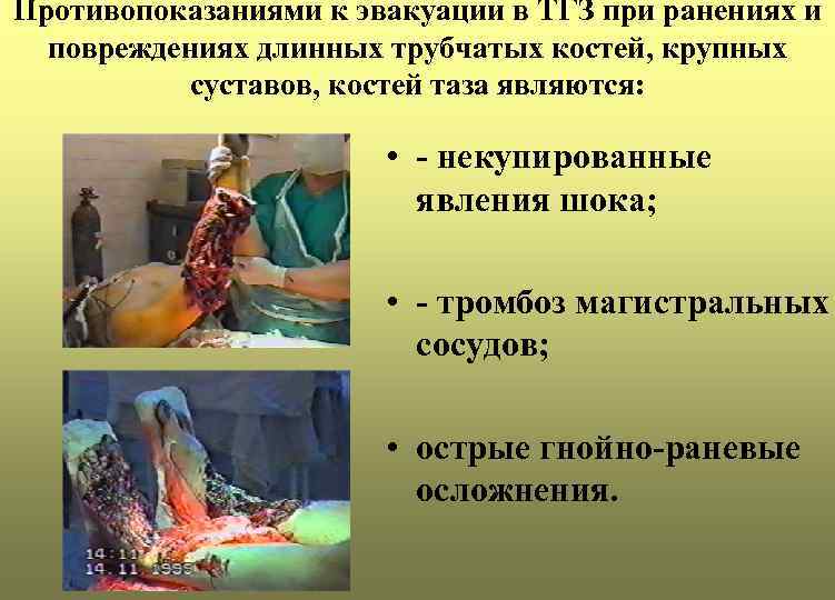 Противопоказаниями к эвакуации в ТГЗ при ранениях и повреждениях длинных трубчатых костей, крупных суставов,