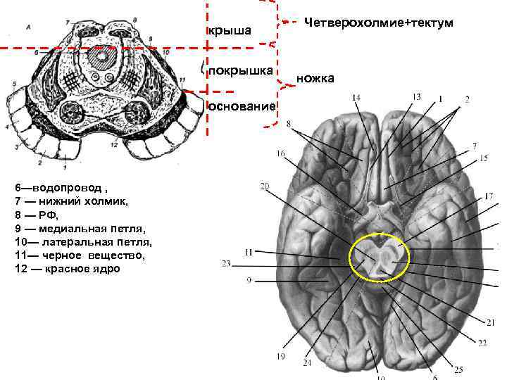 Черное соединение. Черная субстанция красное ядро анатомия. Чёрная субстанция среднего мозга на мрт. Покрышка ствола головного мозга. Средний мозг четверохолмие черная субстанция.