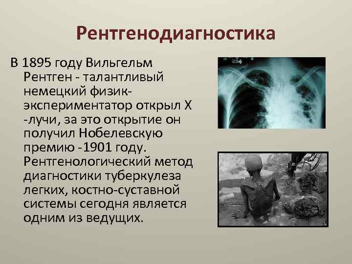 Появление туберкулеза. Туберкулёз презинтация. Туберкулез презентация. Туберкулёз презентация по медицине. История туберкулеза.