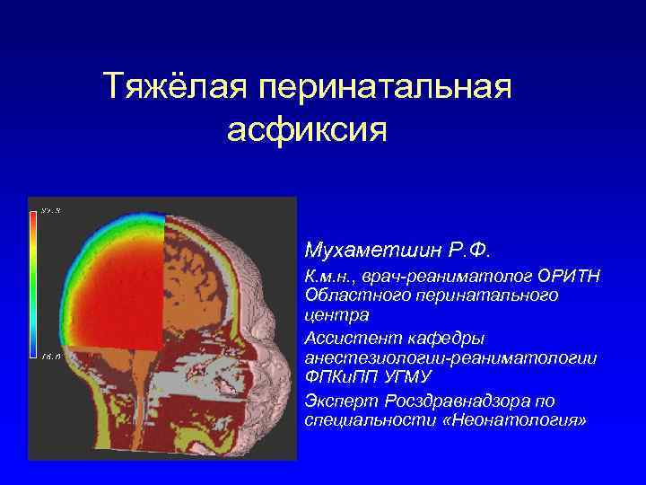 Тяжёлая перинатальная асфиксия Мухаметшин Р. Ф. К. м. н. , врач-реаниматолог ОРИТН Областного перинатального