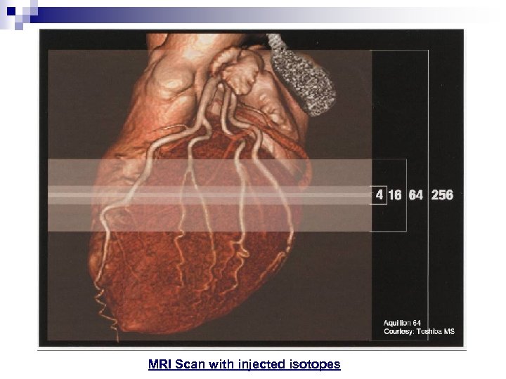 MRI Scan with injected isotopes 