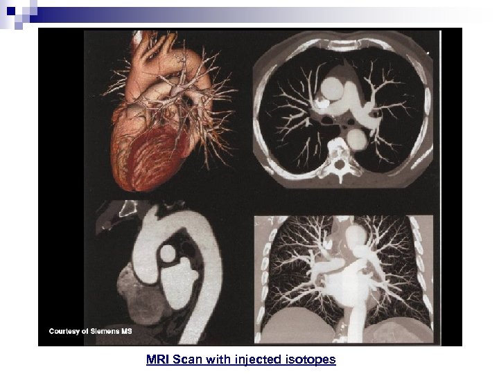 MRI Scan with injected isotopes 