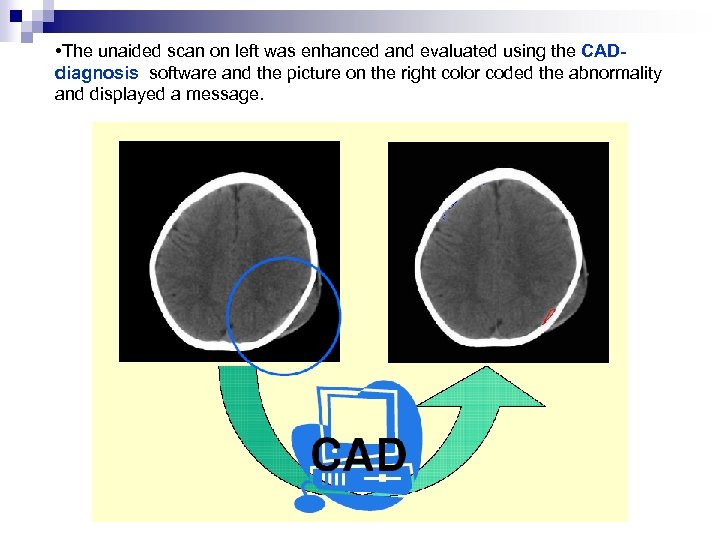  • The unaided scan on left was enhanced and evaluated using the CADdiagnosis