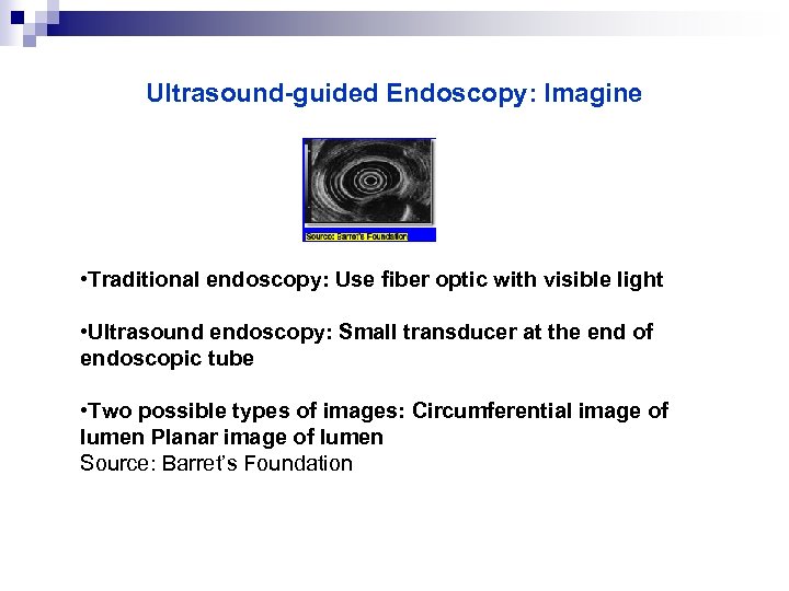 Ultrasound-guided Endoscopy: Imagine • Traditional endoscopy: Use fiber optic with visible light • Ultrasound