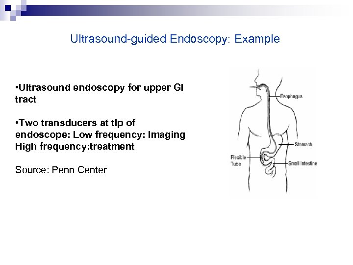 Ultrasound-guided Endoscopy: Example • Ultrasound endoscopy for upper GI tract • Two transducers at