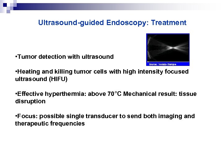 Ultrasound-guided Endoscopy: Treatment • Tumor detection with ultrasound • Heating and killing tumor cells