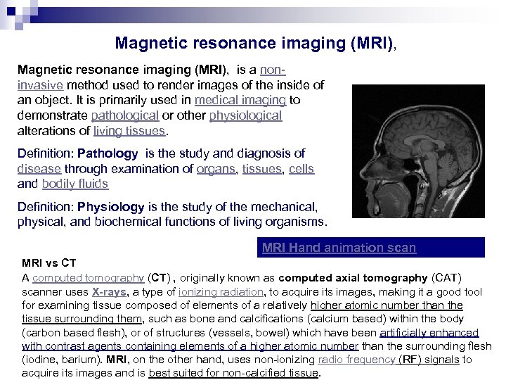 Magnetic resonance imaging (MRI), is a noninvasive method used to render images of the