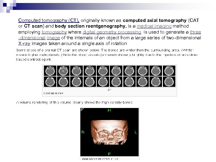 Computed tomography (CT), originally known as computed axial tomography (CAT or CT scan) and