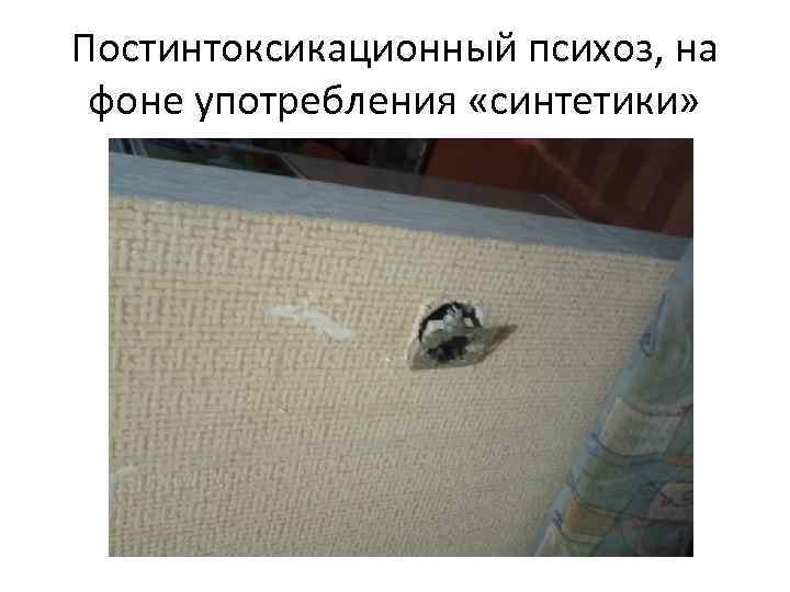 Постинтоксикационный психоз, на фоне употребления «синтетики» 