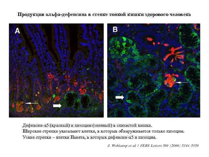 Продукция альфа-дефенсина в стенке тонкой кишки здорового человека Дефенсин-α 5 (красный) и лизоцим (зеленый)