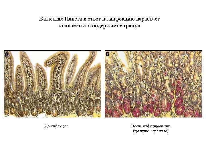В клетках Панета в ответ на инфекцию нарастает количество и содержимое гранул До инфекции