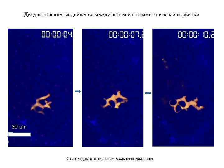 Дендритная клетка движется между эпителиальными клетками ворсинки 30 µm Стоп-кадры с интервалом 3 сек
