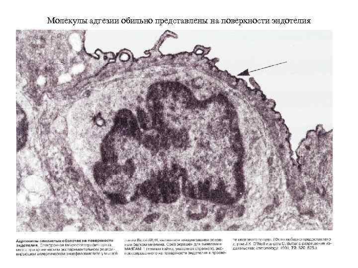 Молекулы адгезии обильно представлены на поверхности эндотелия 