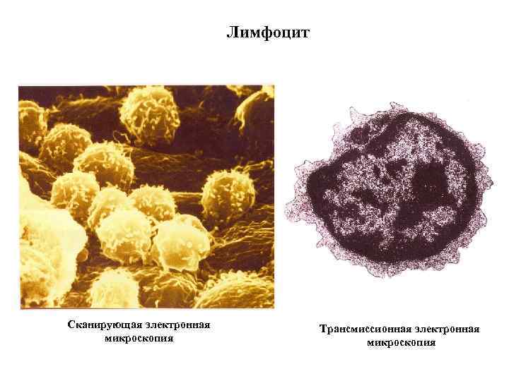 Лимфоцит Сканирующая электронная микроскопия Трансмиссионная электронная микроскопия 