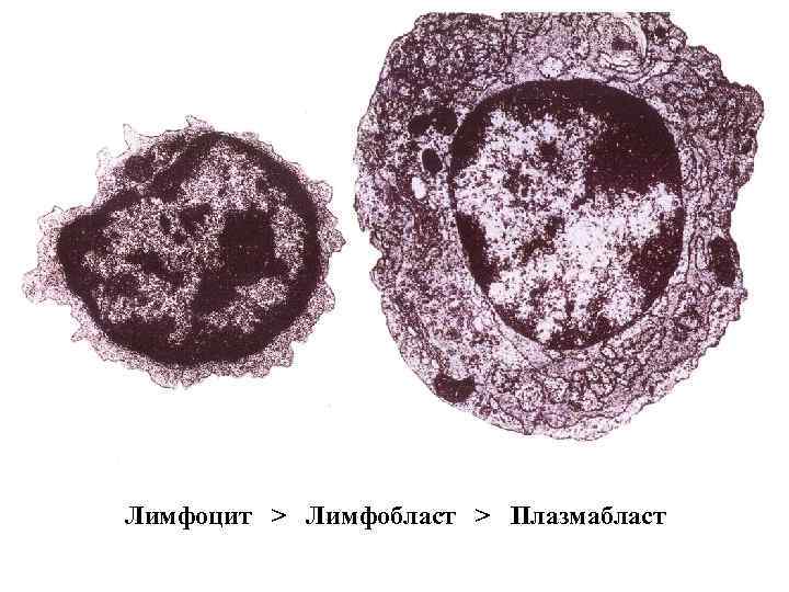 Лимфоцит > Лимфобласт > Плазмабласт 