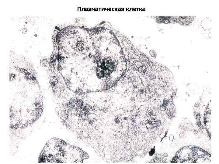 Плазматическая клетка 