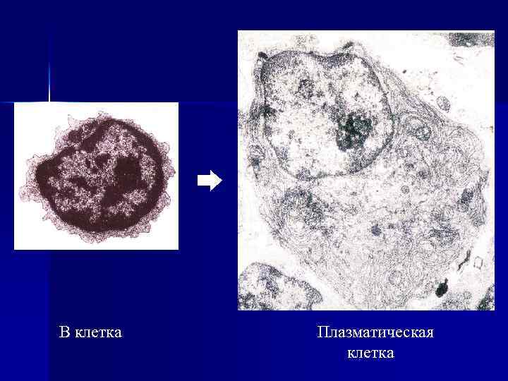 В клетка Плазматическая клетка 