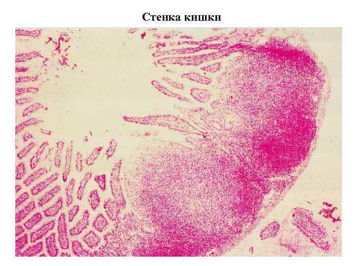 Стенка кишки 