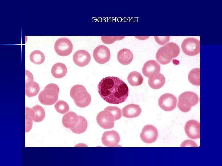 ЭОЗИНОФИЛ 