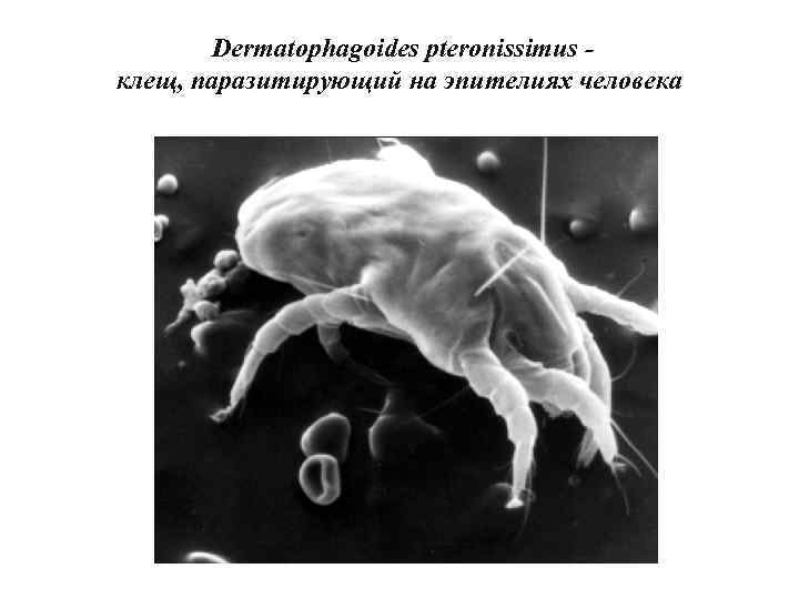 Dermatophagoides pteronissimus клещ, паразитирующий на эпителиях человека. 