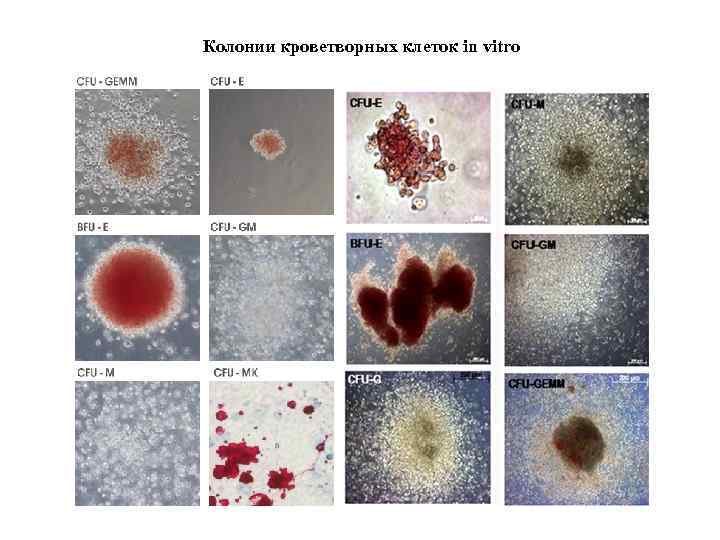 Колонии кроветворных клеток in vitro 