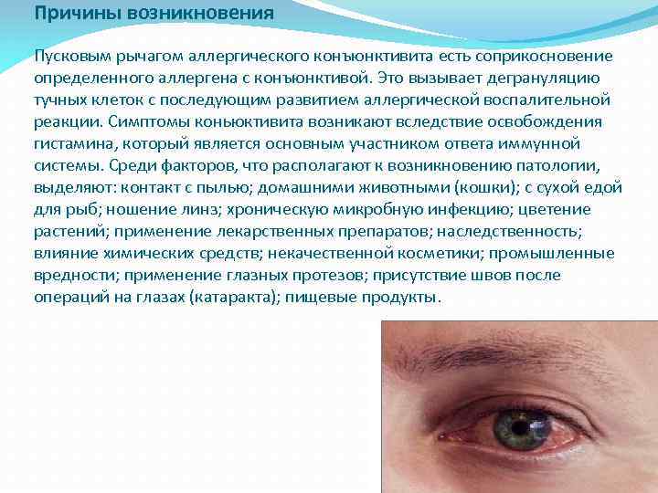 Причины возникновения Пусковым рычагом аллергического конъюнктивита есть соприкосновение определенного аллергена с конъюнктивой. Это вызывает