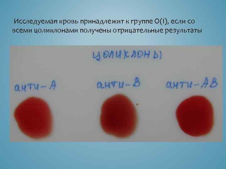  Исследуемая кровь принадлежит к группе О(I), если со всеми цоликлонами получены отрицательные результаты