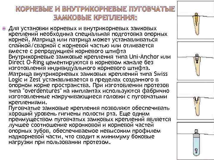  Для установки корневых и внутрикорневых замковых креплений необходима специальная подготовка опорных корней. Матрица