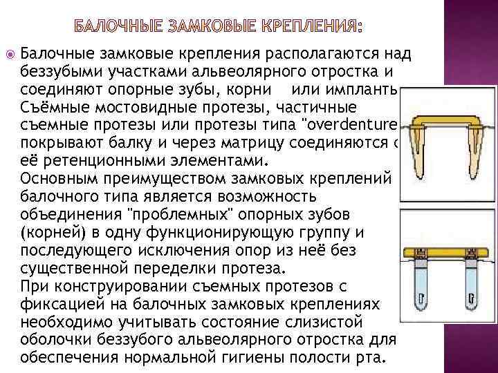  Балочные замковые крепления располагаются над беззубыми участками альвеолярного отростка и соединяют опорные зубы,