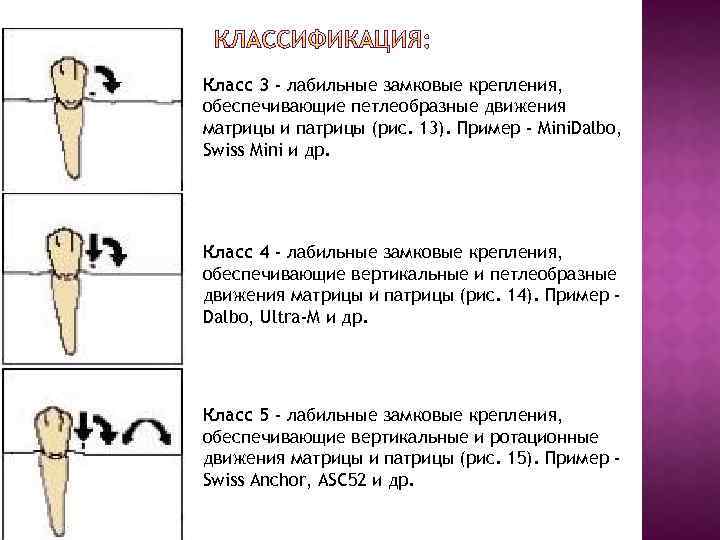 Класс 3 - лабильные замковые крепления, обеспечивающие петлеобразные движения матрицы и патрицы (рис. 13).