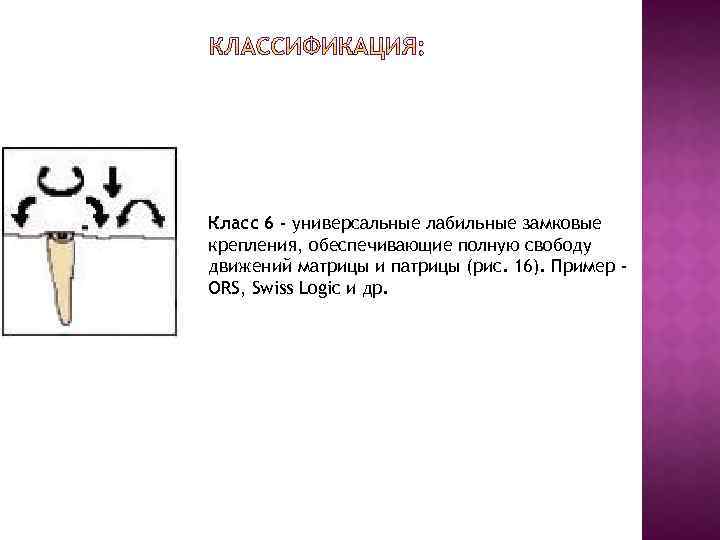 Класс 6 - универсальные лабильные замковые крепления, обеспечивающие полную свободу движений матрицы и патрицы