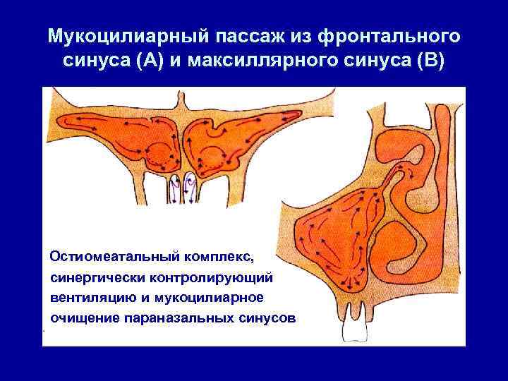 Мукоцилиарный пассаж из фронтального синуса (А) и максиллярного синуса (В) Остиомеатальный комплекс, синергически контролирующий