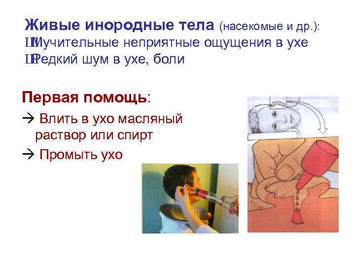 Живые инородные тела (насекомые и др. ): Ш Мучительные неприятные ощущения в ухе Ш