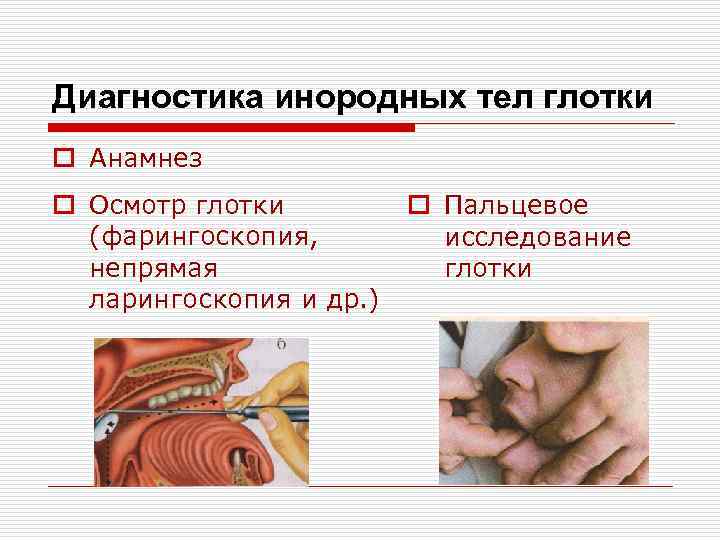 Диагностика инородных тел глотки o Анамнез o Осмотр глотки (фарингоскопия, непрямая ларингоскопия и др.