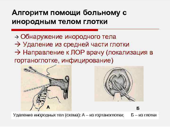 Инородное тело носа карта вызова