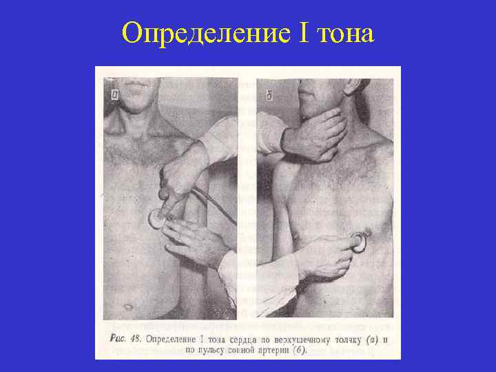 Определение I тона 