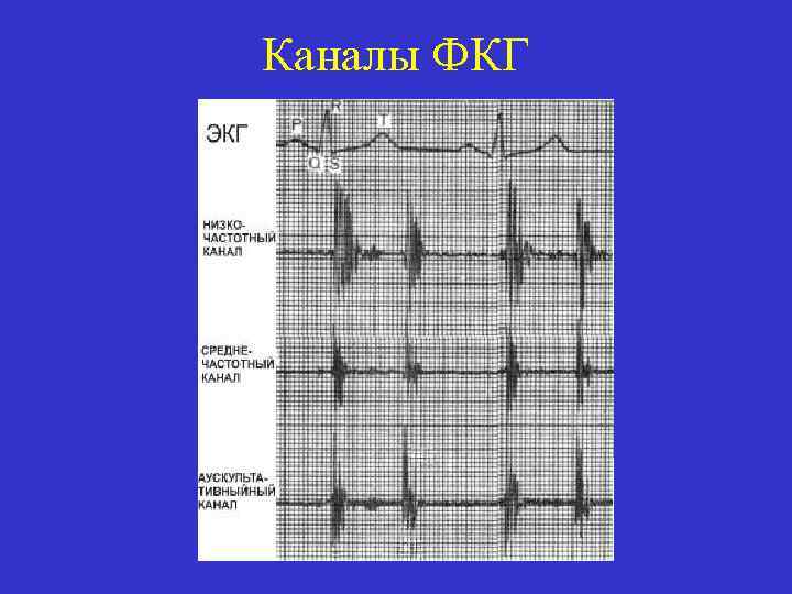 Каналы ФКГ 