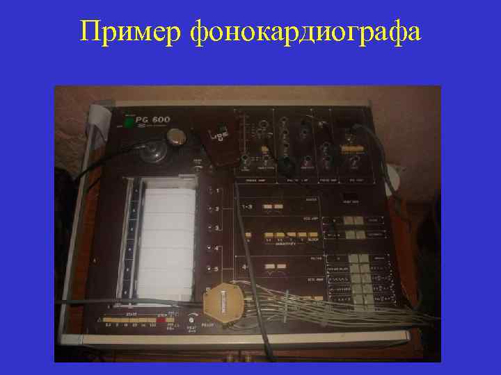 Пример фонокардиографа 