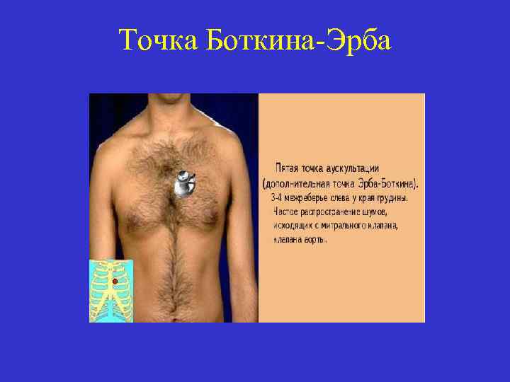 Точка Боткина-Эрба 