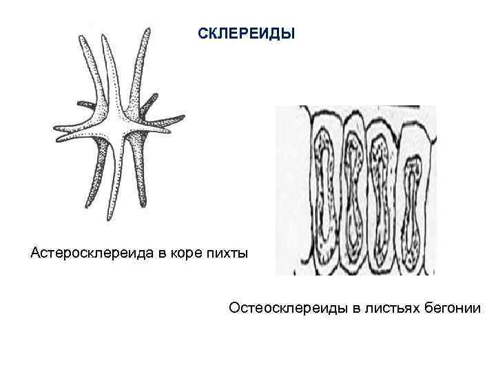 СКЛЕРЕИДЫ Астеросклереида в коре пихты Остеосклереиды в листьях бегонии 