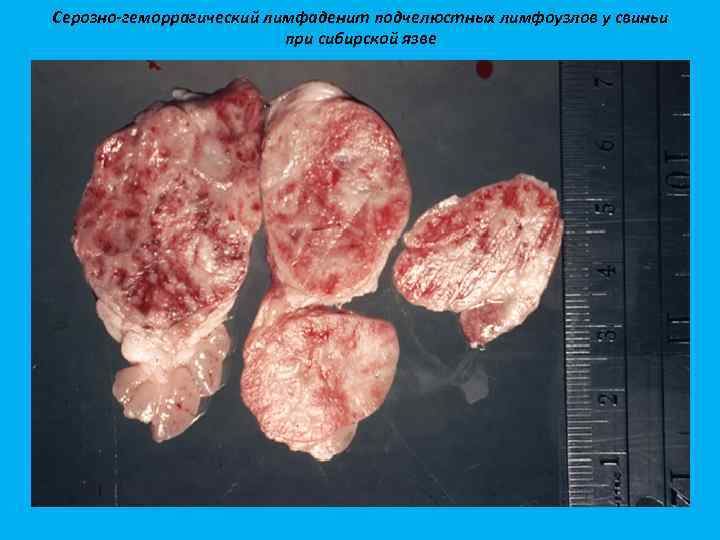 Серозно-геморрагический лимфаденит подчелюстных лимфоузлов у свиньи при сибирской язве 