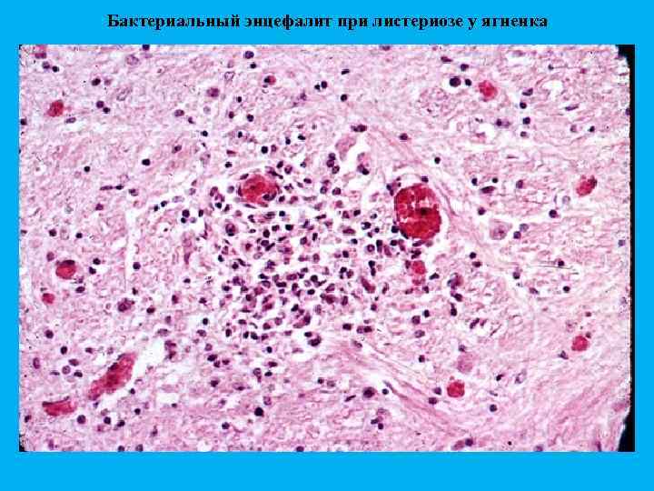 Бактериальный энцефалит при листериозе у ягненка 