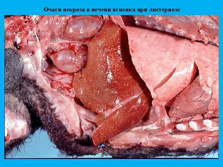 Очаги некроза в печени ягненка при листериозе 