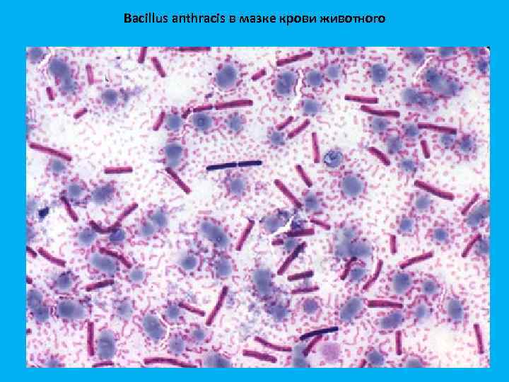 Bacillus anthracis в мазке крови животного 