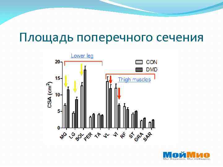 Площадь поперечного сечения 