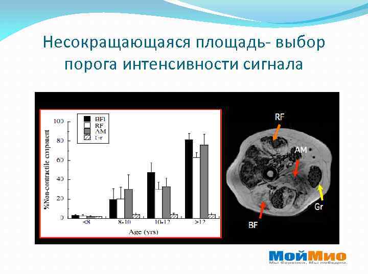 Несокращающаяся площадь- выбор порога интенсивности сигнала 