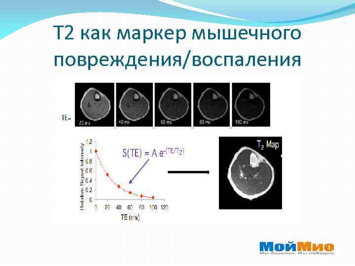 Т 2 как маркер мышечного повреждения/воспаления 