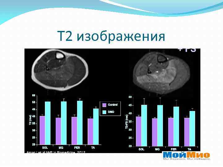 Т 2 изображения 