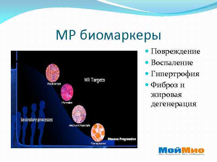МР биомаркеры Повреждение Воспаление Гипертрофия Фиброз и жировая дегенерация 